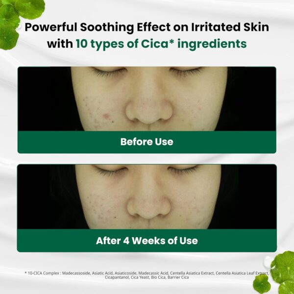 Dr.G Red Blemish Clear Soothing Korean Moisturizer Face Cream, 70ml - Cica Cream, Korean Skin Care Moisturizer, Korean Face Moisturizer, Facial Moisturizer, Korean Skincare, K Beauty Skincare Coreano - Image 3
